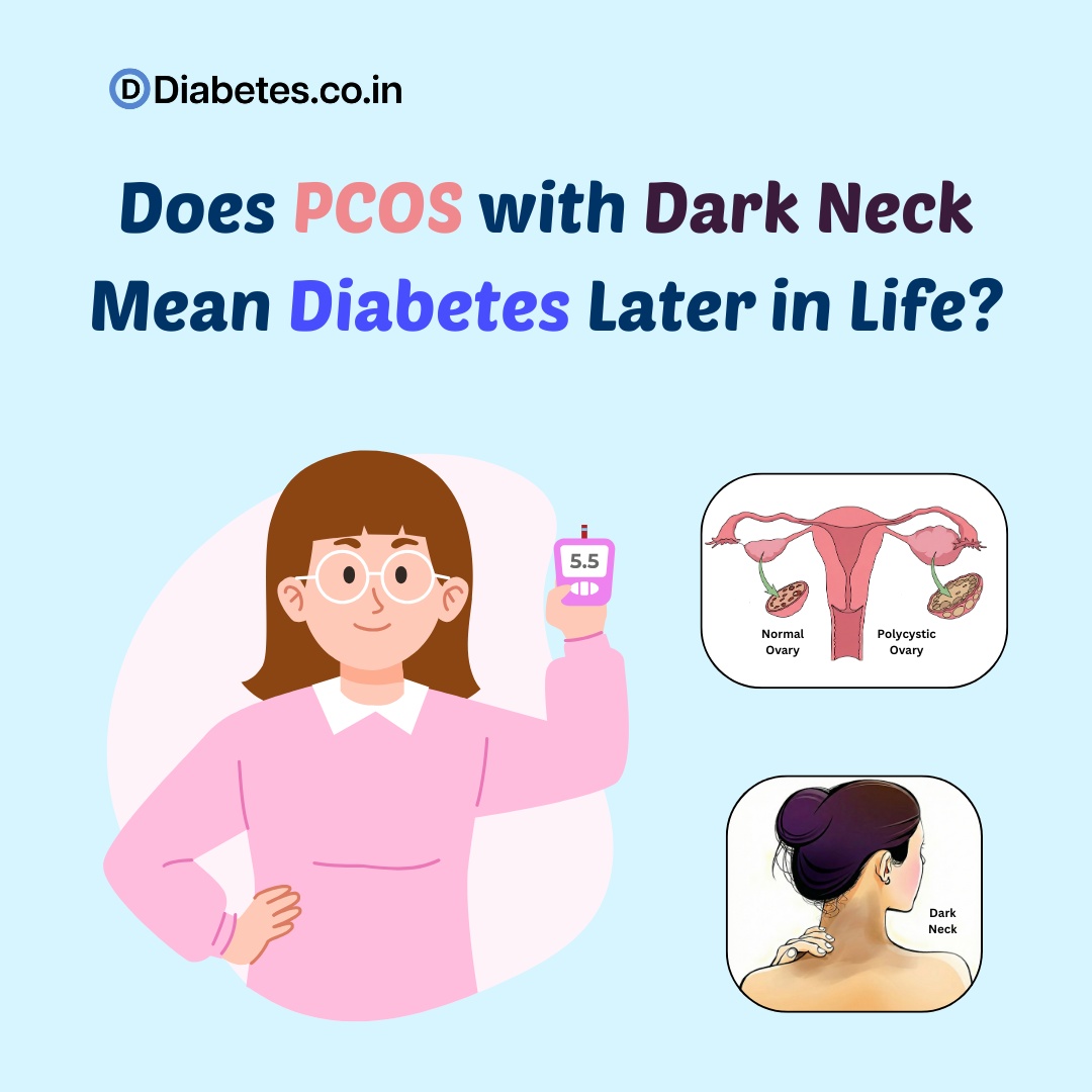 Does PCOS with Dark Neck Mean Diabetes Later in Life?