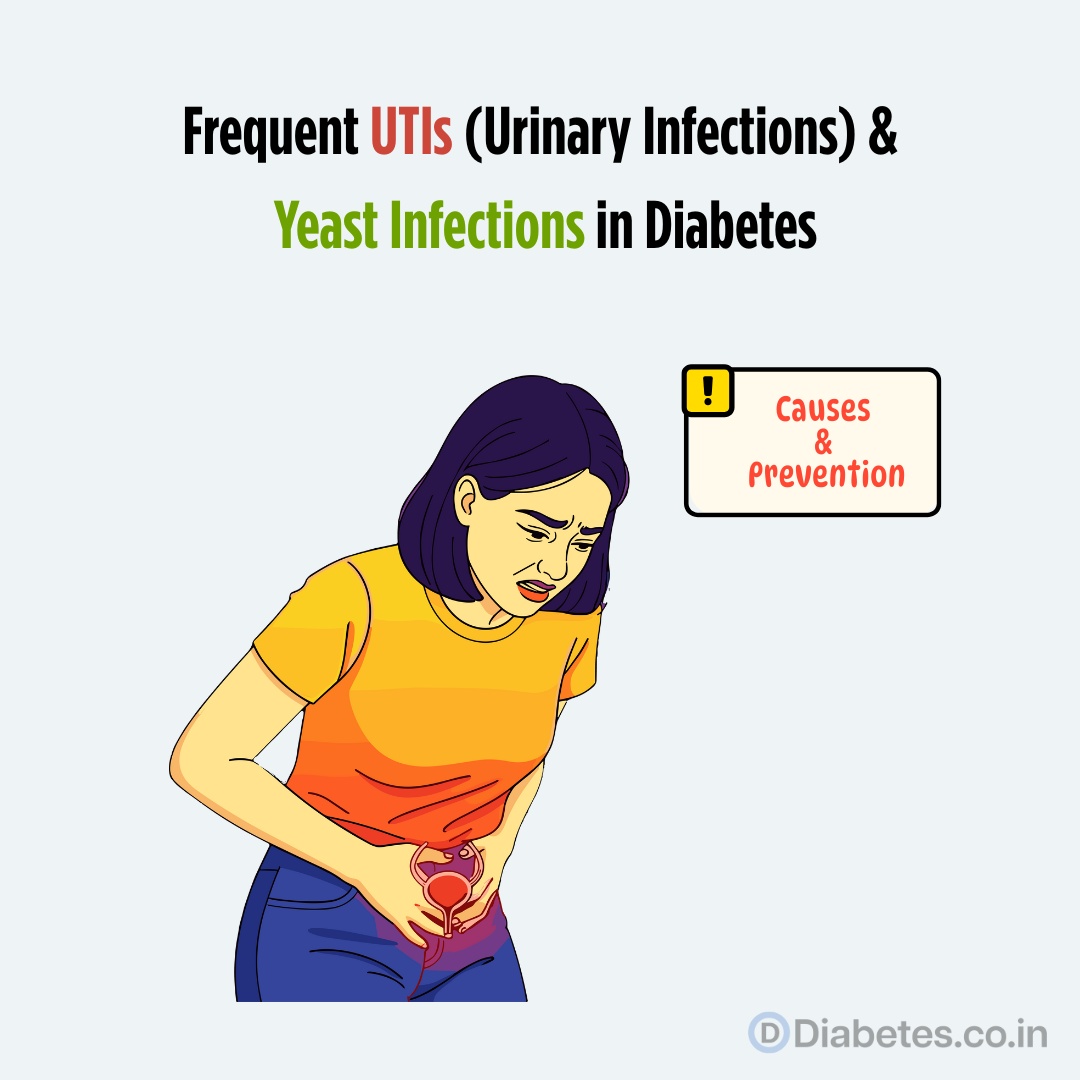 Frequent UTIs (Urinary Infections) &  Yeast Infections in Diabetes