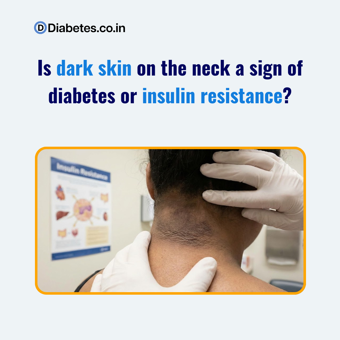Is dark skin on the neck a sign of diabetes or insulin resistance?