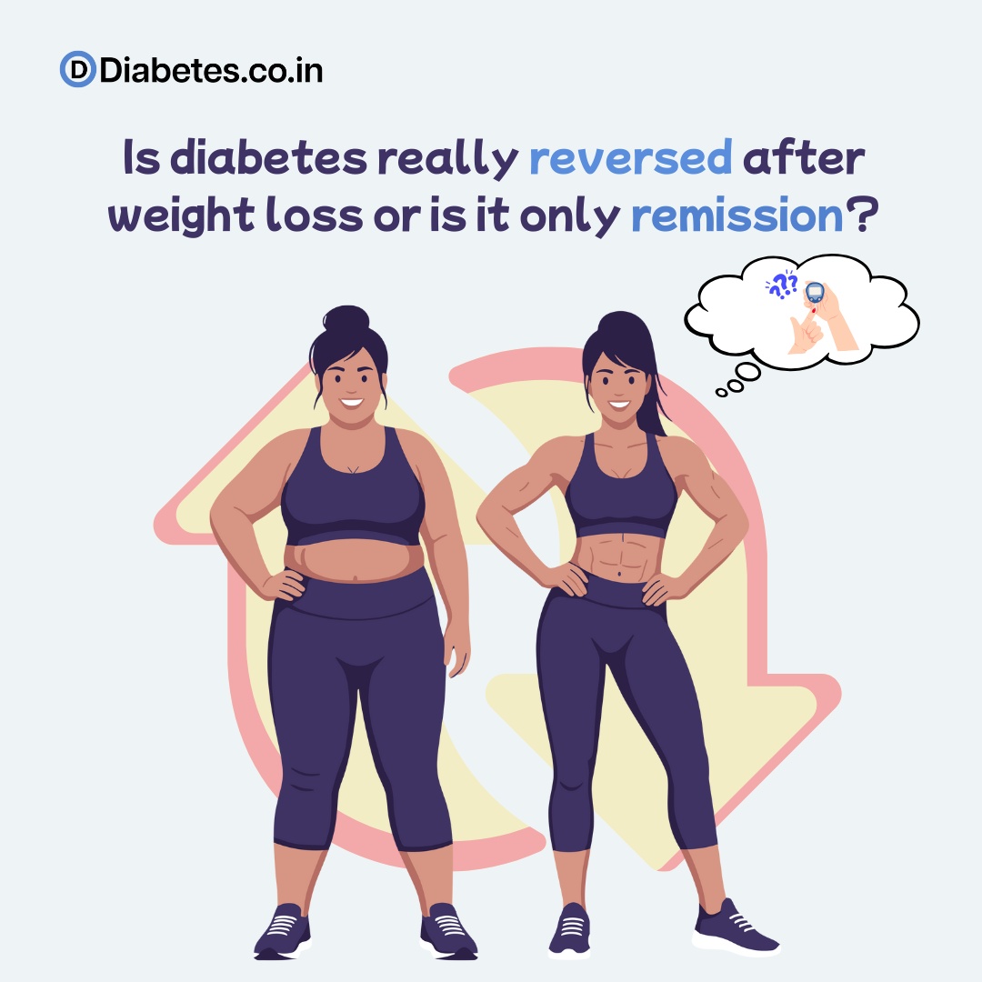 Is diabetes really reversed after weight loss or is it only remission1