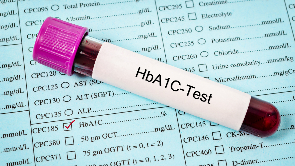  HbA1c Testing- Do I Need to Fast, and Should I Check It Every 3 or 6 Months?