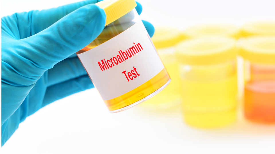 Urine “Microalbumin” Test in Diabetes- How Often Should It Be Checked?
